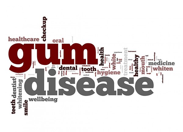 Treating Gum Disease In Our Office And In Your Home