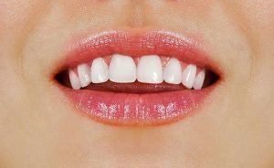 6 Tips For Healthy White Teeth From Your BDF Dental Dentist f