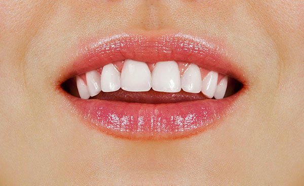 6 Tips For Healthy White Teeth From Your BDF Dental Dentist